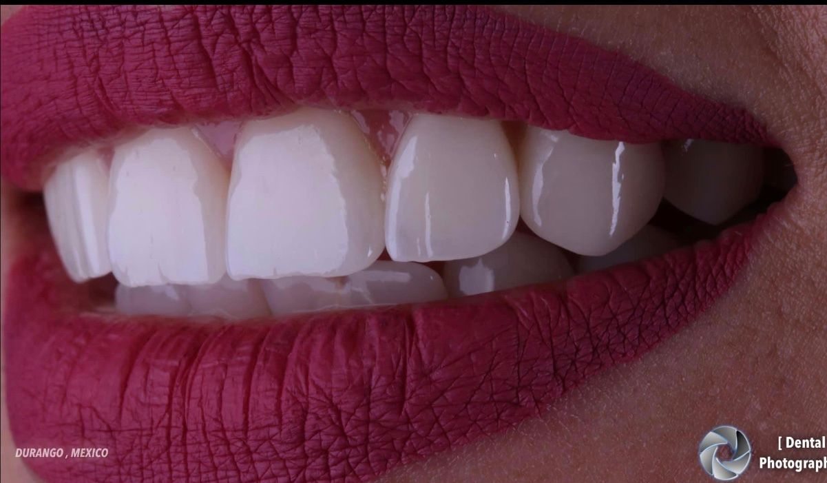 Ernesto Rojas Calderon-22