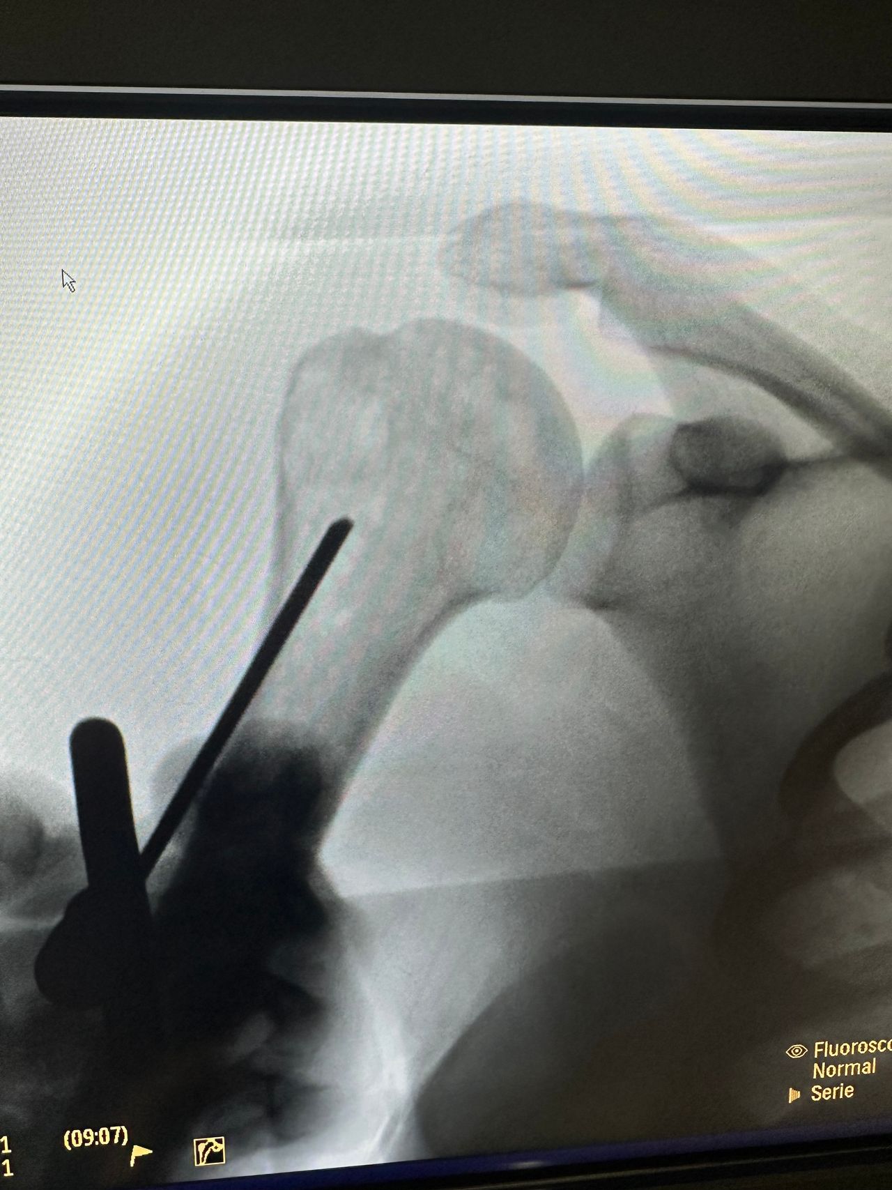 Hernán Lindoro Félix-2