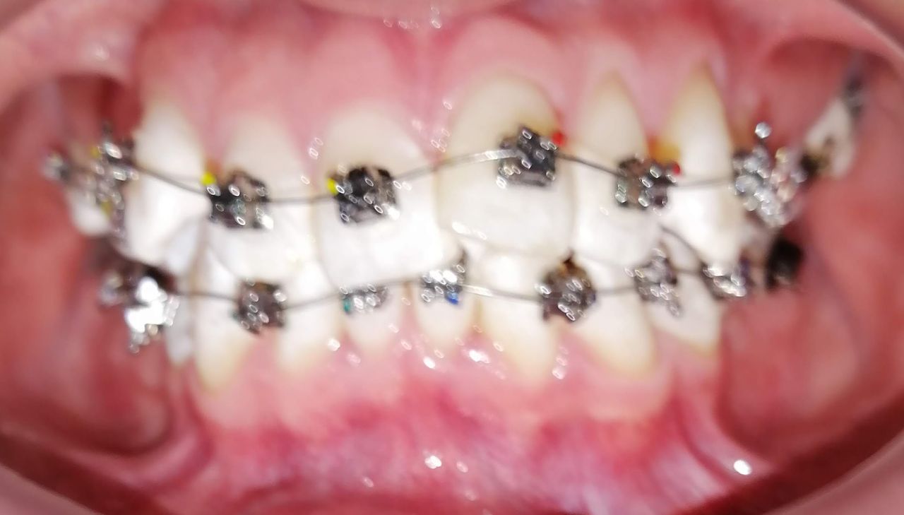 Yaneth Gutiérrez Sánchez-31