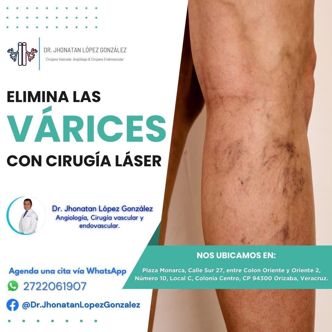 Jhonatan López González-84