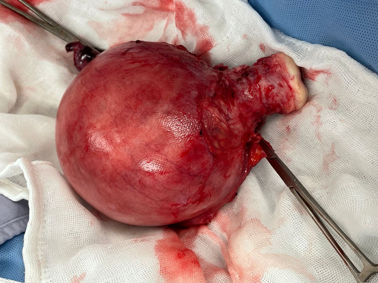 Gonzalo Hernández Martínez-39