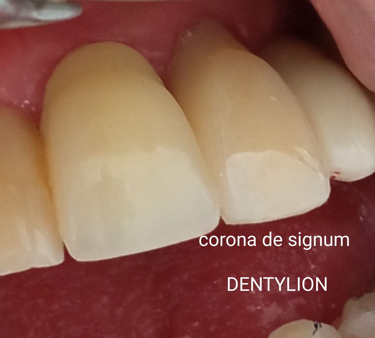 Jessica De La Barrera Valladolid-44