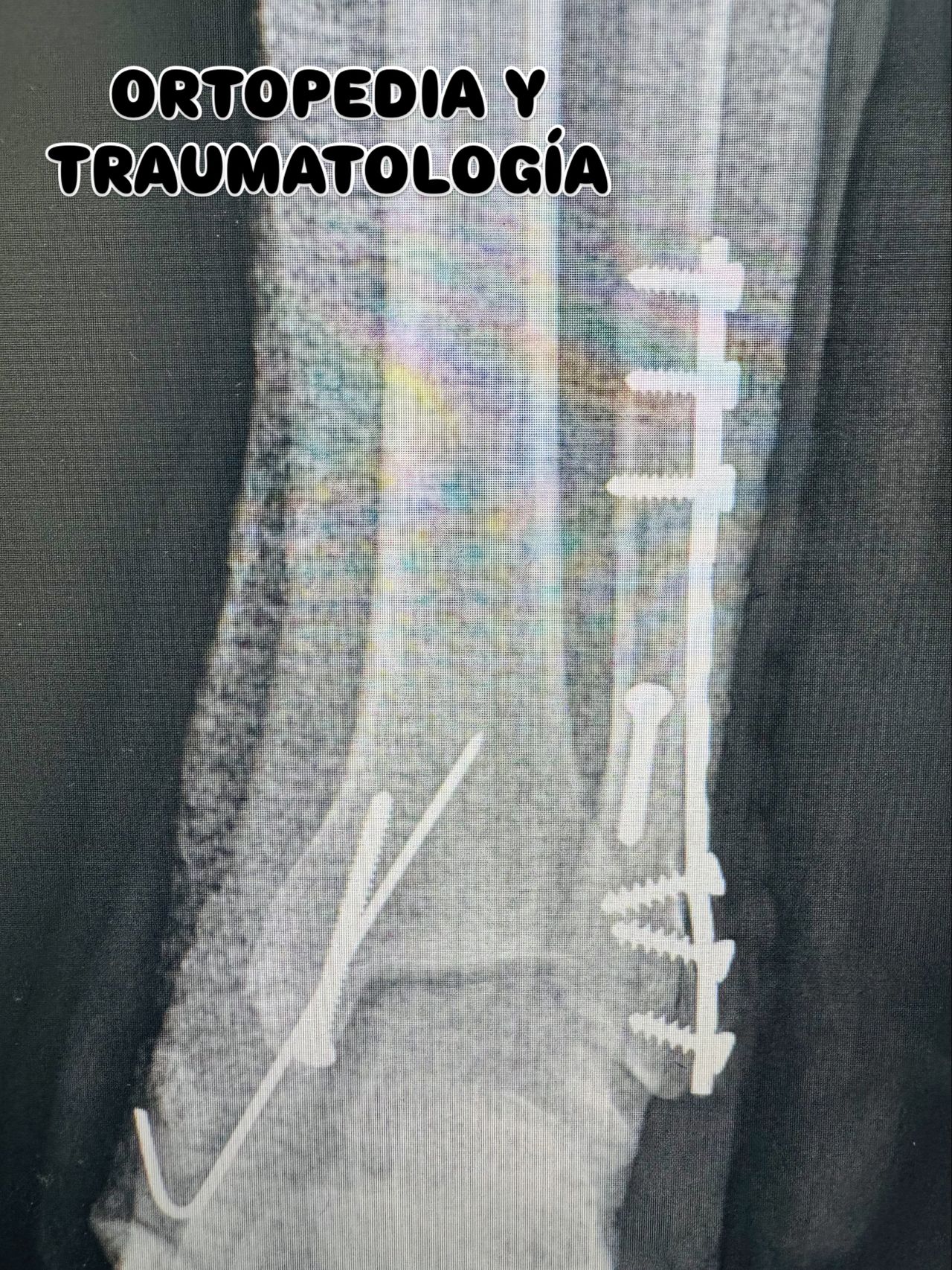 Héctor Benito Lazaro-4