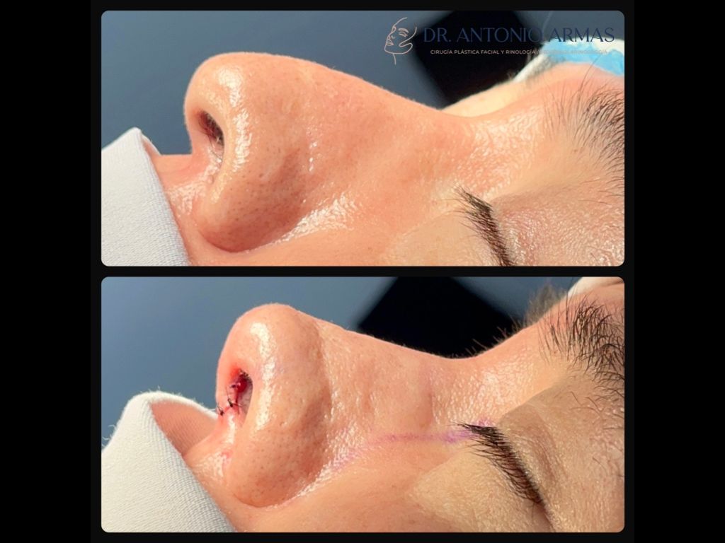 Juan Antonio González Armas-7