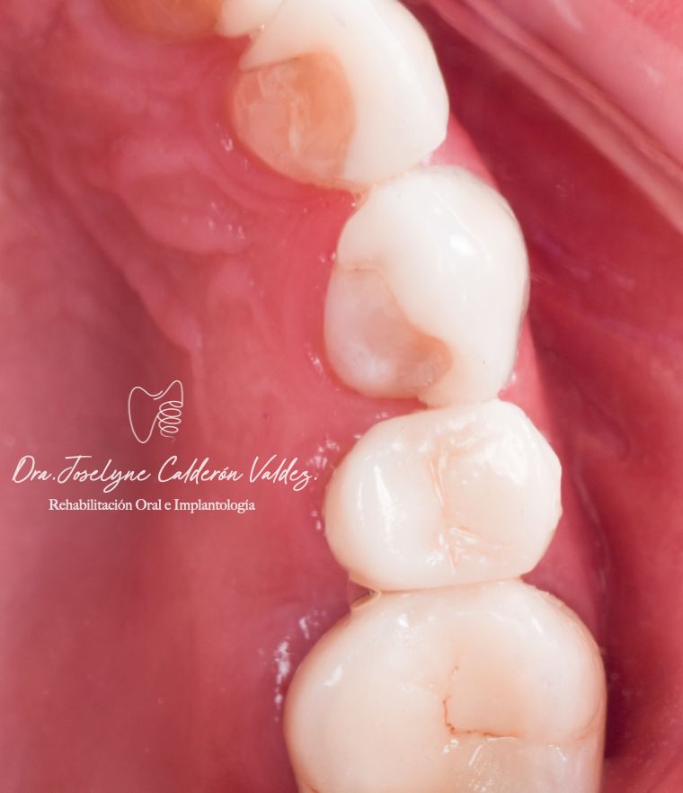 Joselyne Calderón Valdez-5