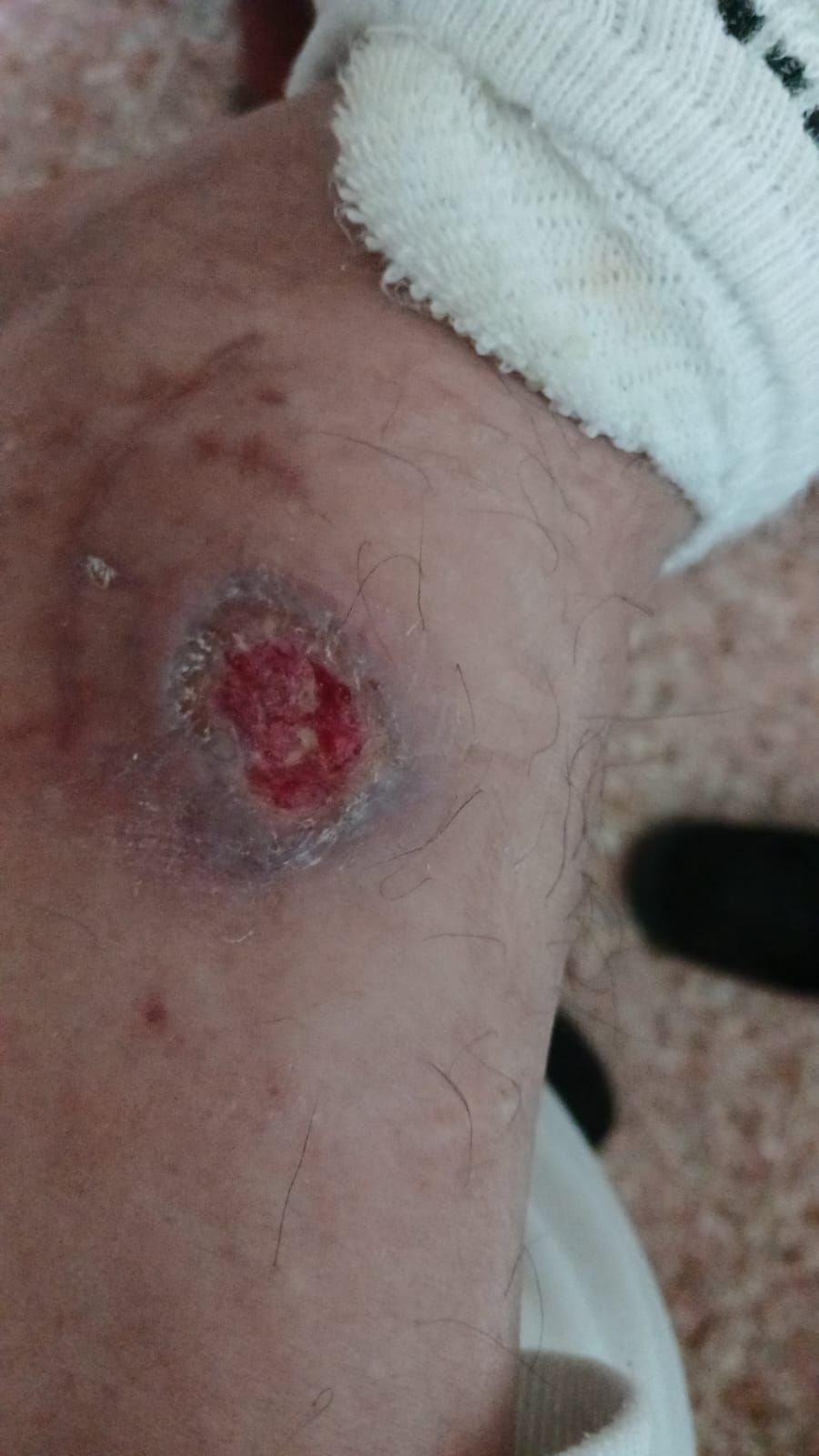 Alejandro Irisson-35