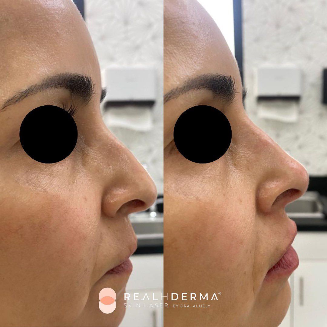 Laura Alheli Niebla Maldonado-12