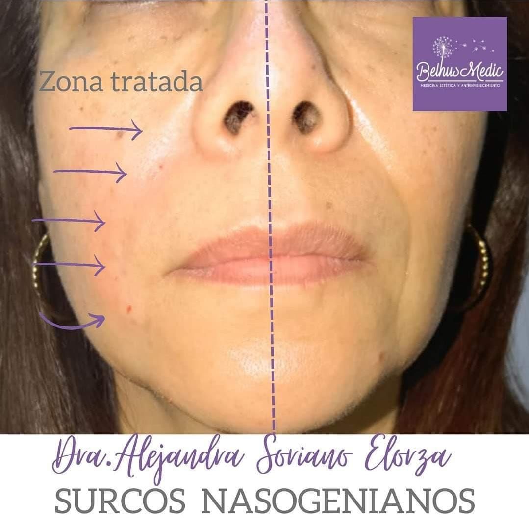 Alejandra Soriano Elorza-36