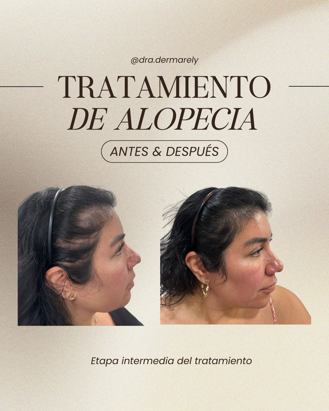 Arely M. Gastélum-14