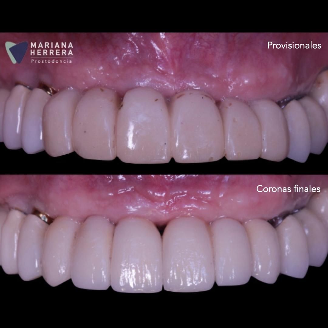 Mariana Herrera Martín Del Campo-22