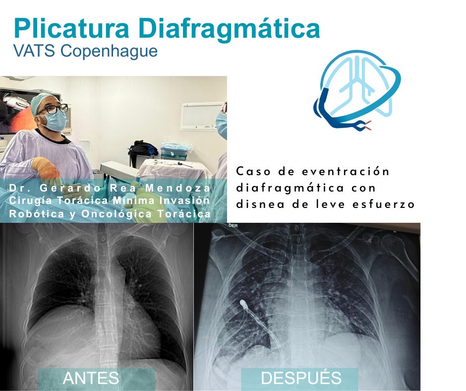 Gerardo Rea Mendoza-5