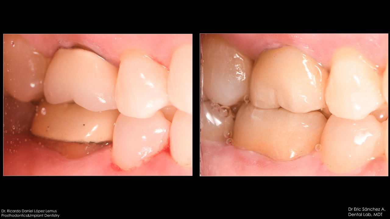 Ricardo López Lemus-36