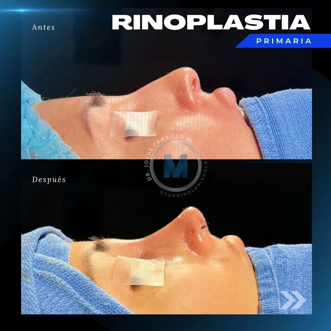 Josué Carrillo Mendiburu-9