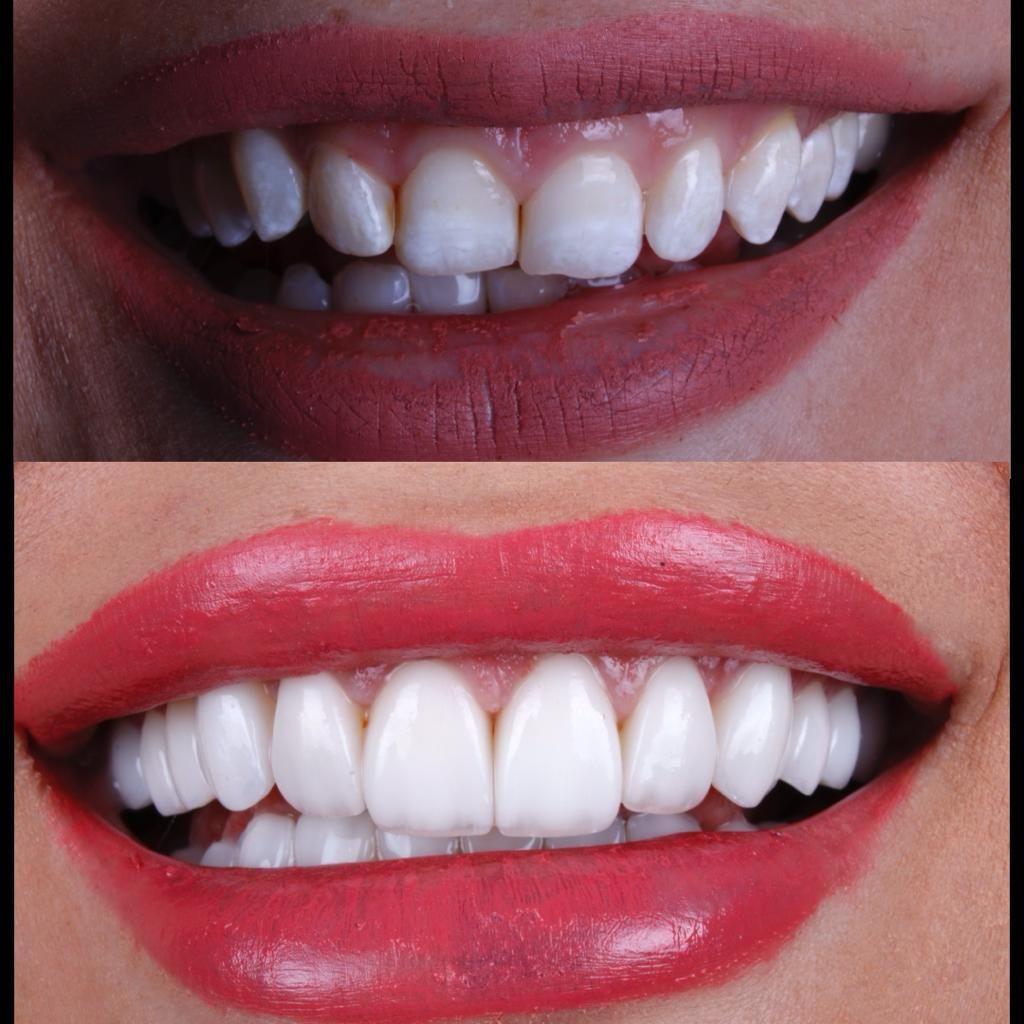 Oscar Raygoza Carrillo-10