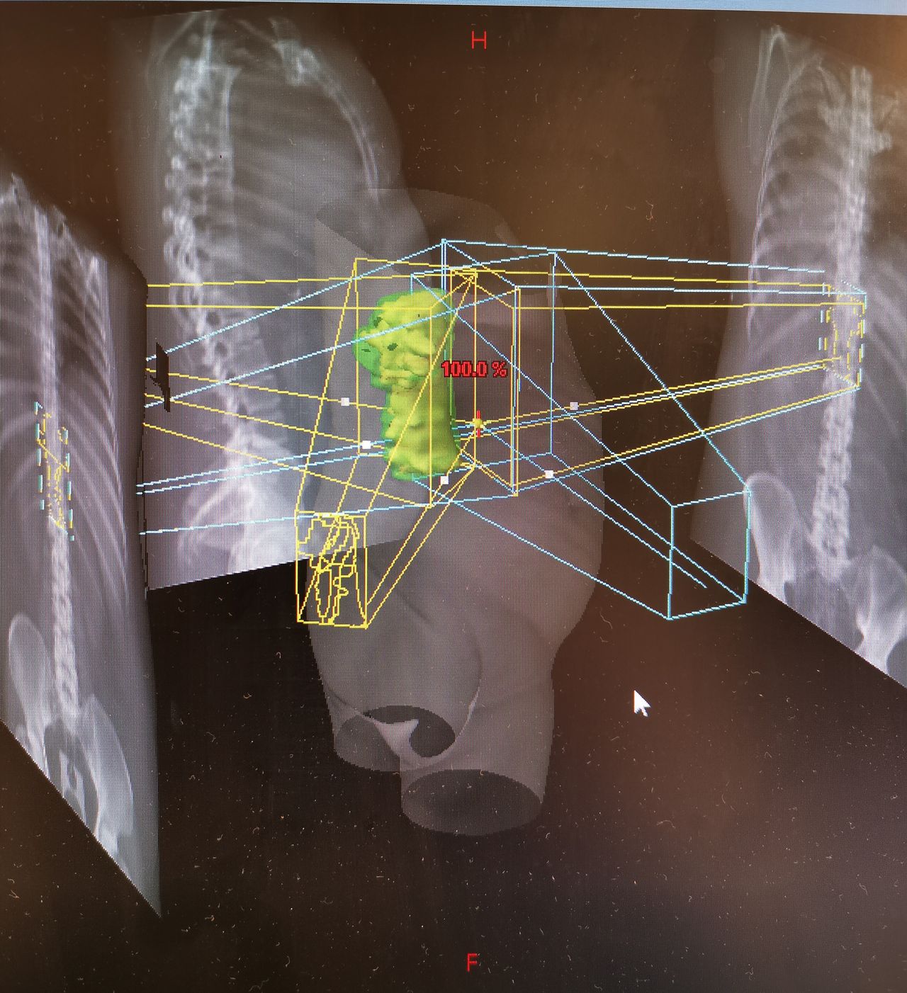 Hugo Francisco Romero Anduaga-14