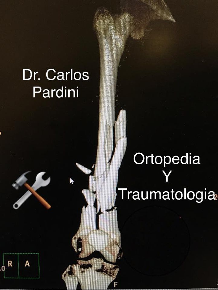 Carlos Gpe. Pardini Angulo-11