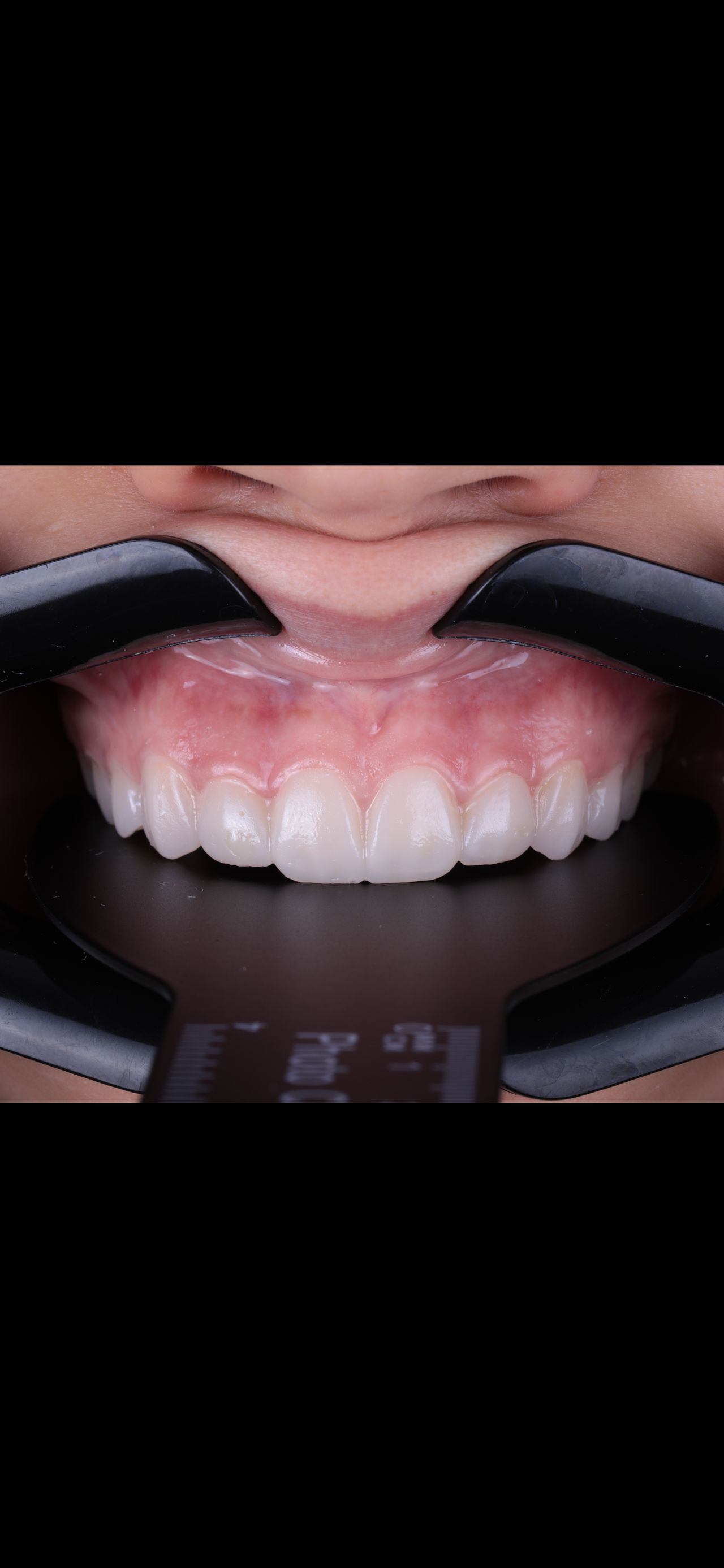 Itzel Abigail Montiel Garces-0