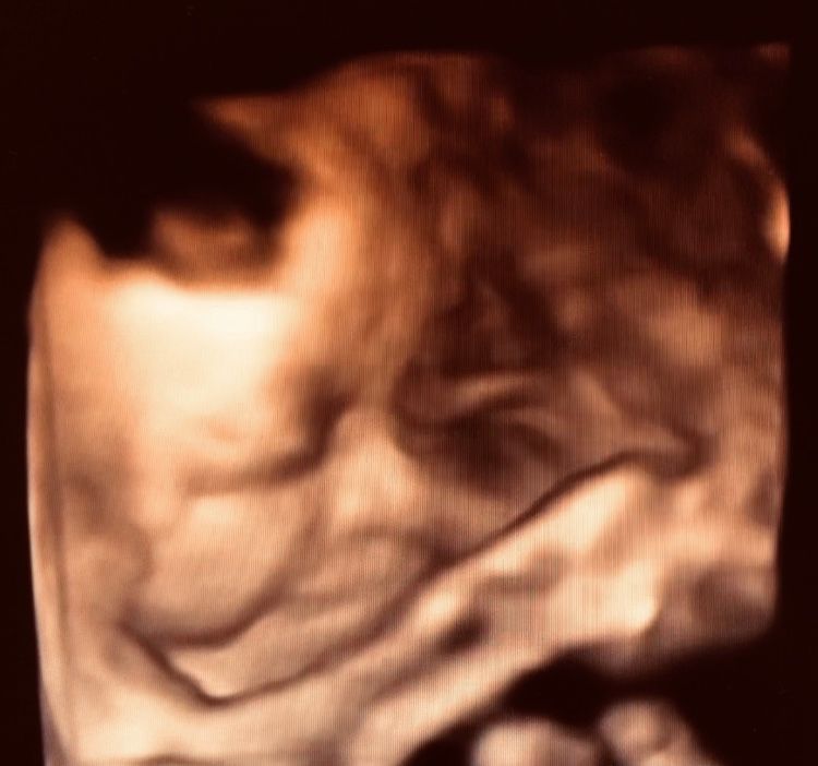 Brenda Lisset Briones Bernal-19