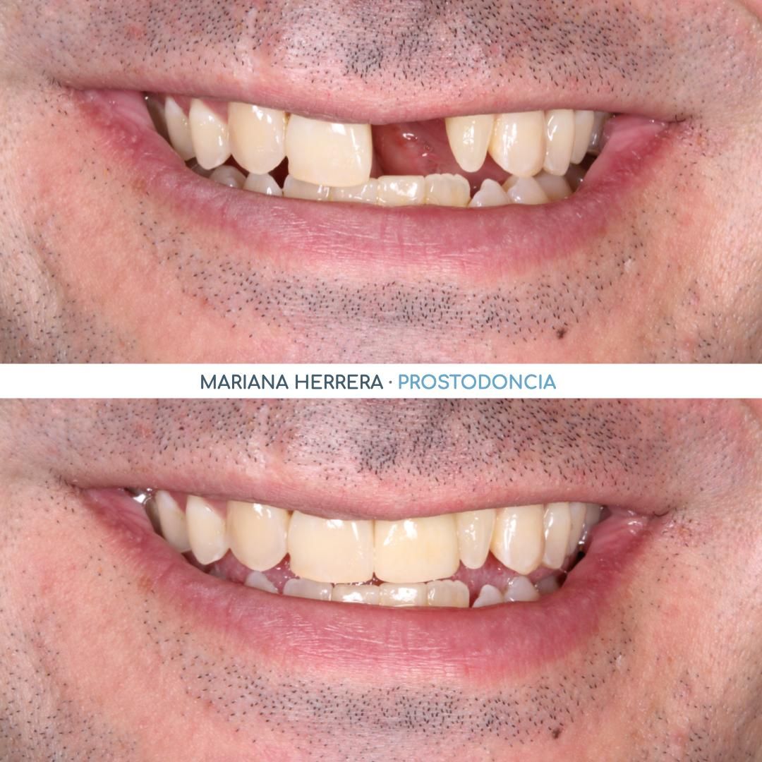 Mariana Herrera Martín Del Campo-11