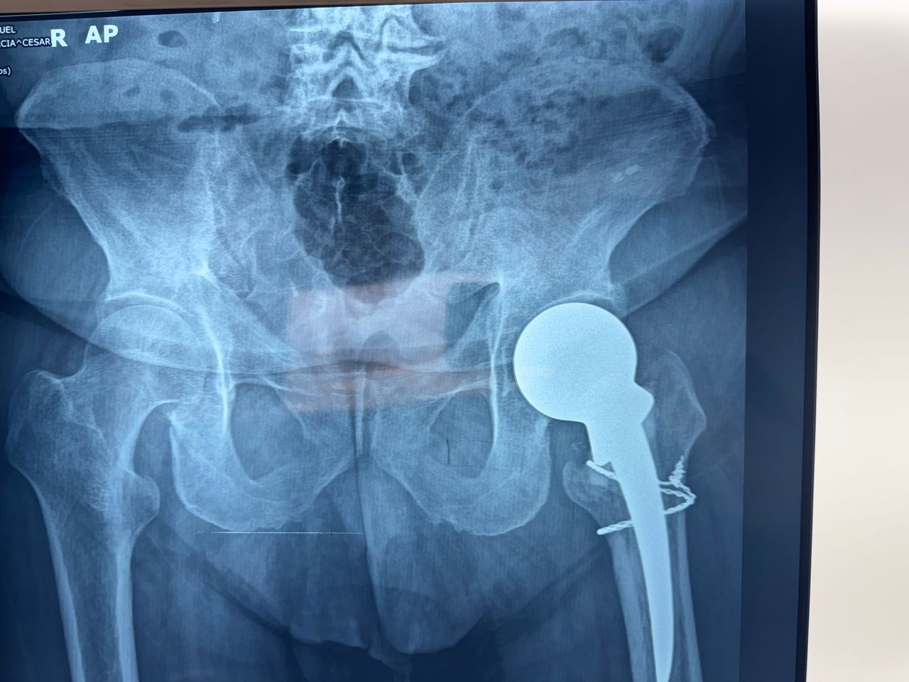 Arturo Domínguez Millán-6