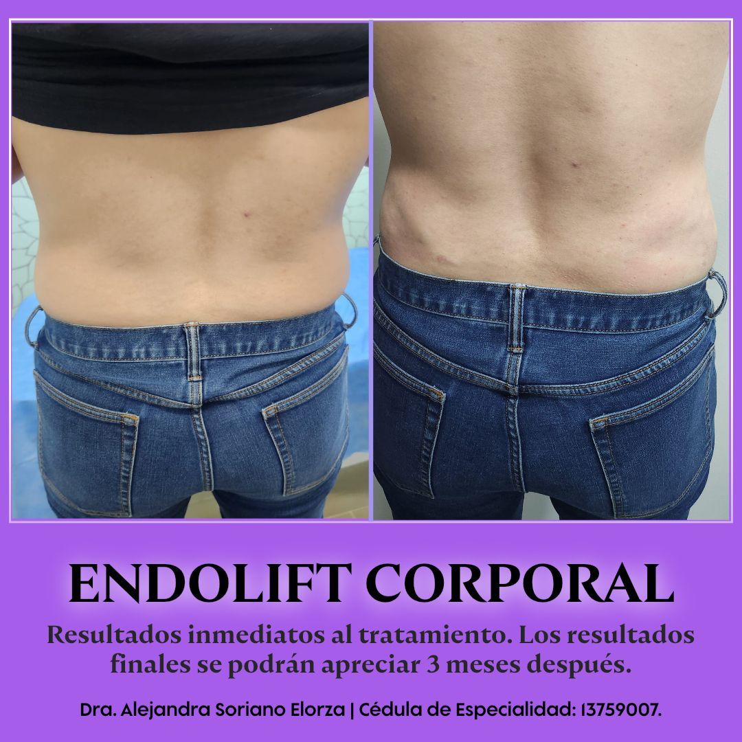 Alejandra Soriano Elorza-12