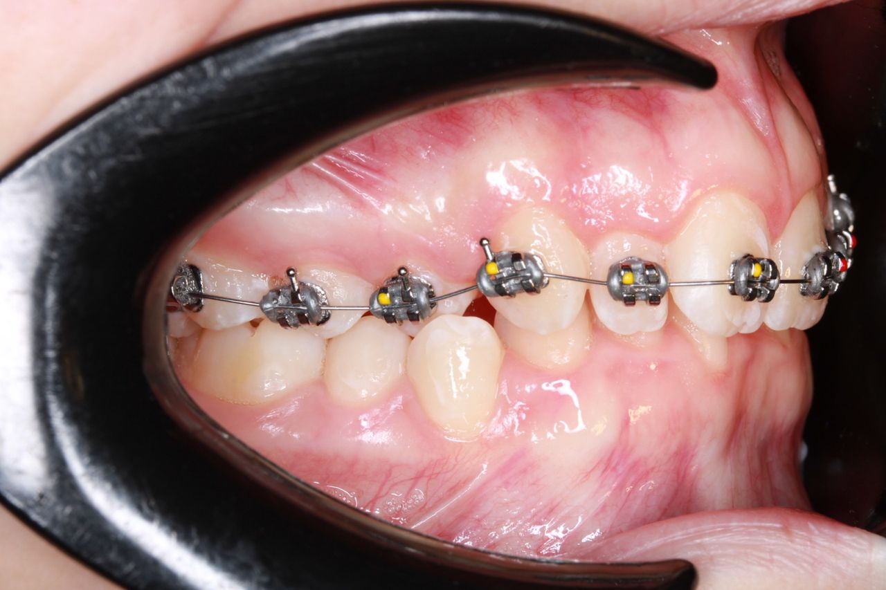 César Osvaldo Poot Chan-2