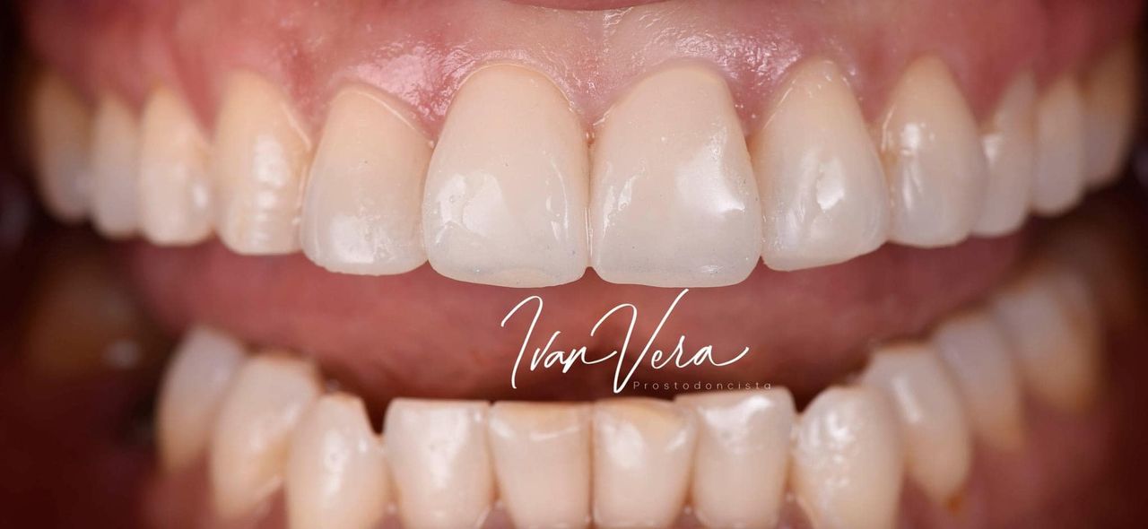 Eduardo Ivan Vera Velez-8