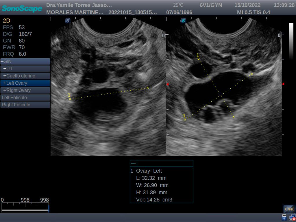 Yamile Torres Jasso-15