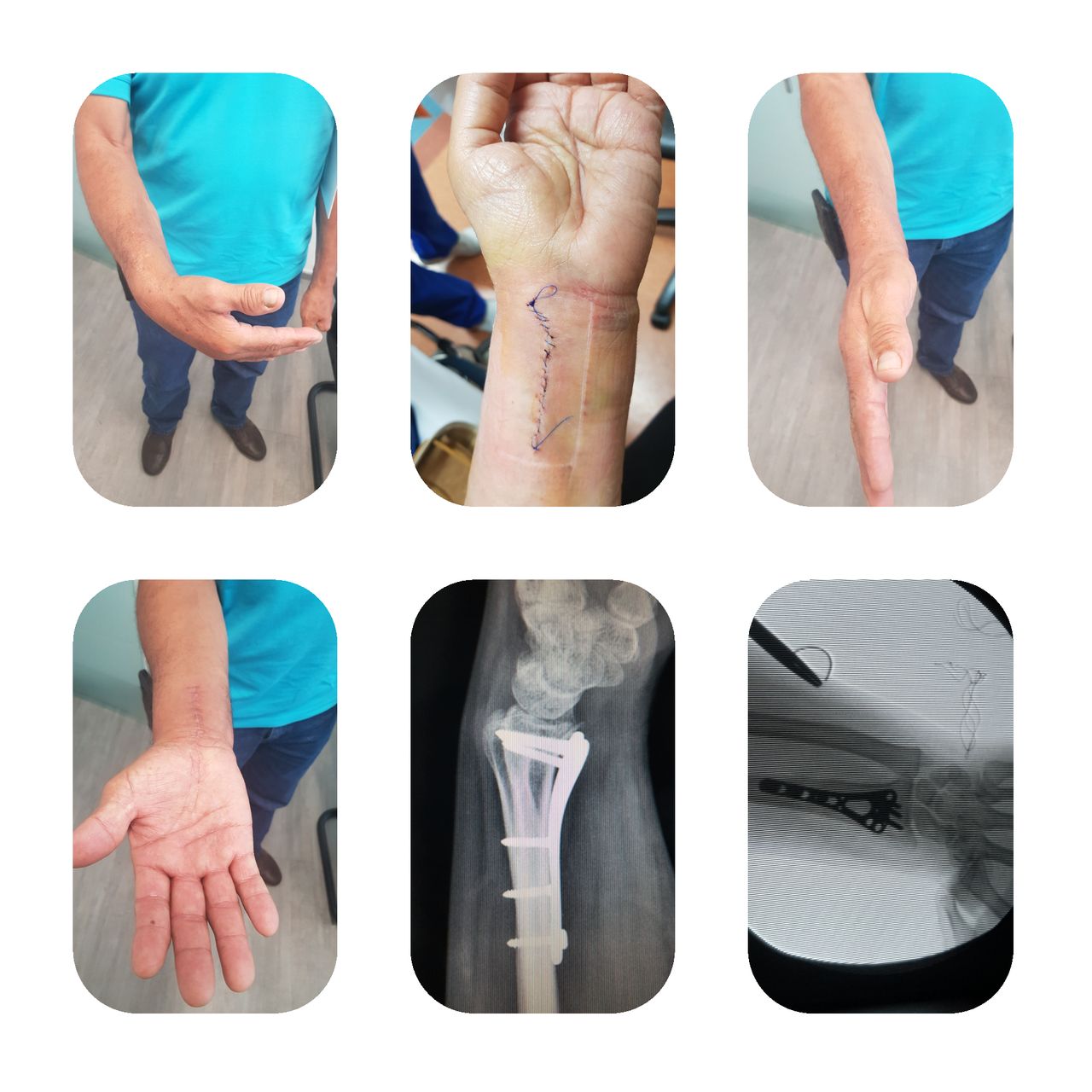 Esteban Castro Contreras-6