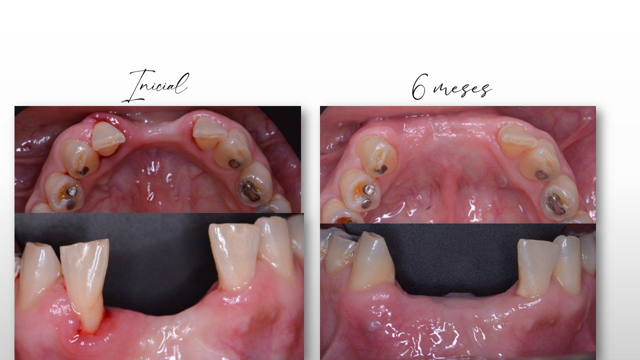 Berenice Ontiveros-3