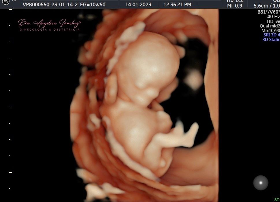 Angélica Ma. Sánchez Castro-10