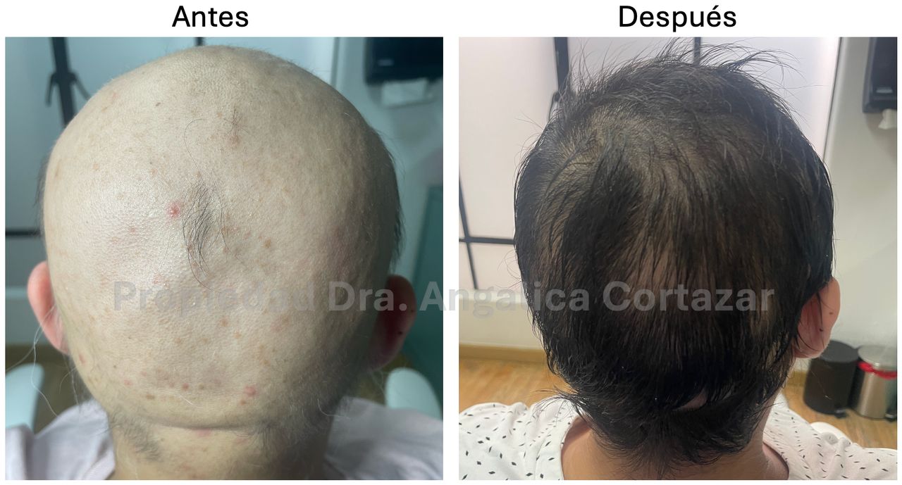 Angélica María Cortázar Azuaje-11