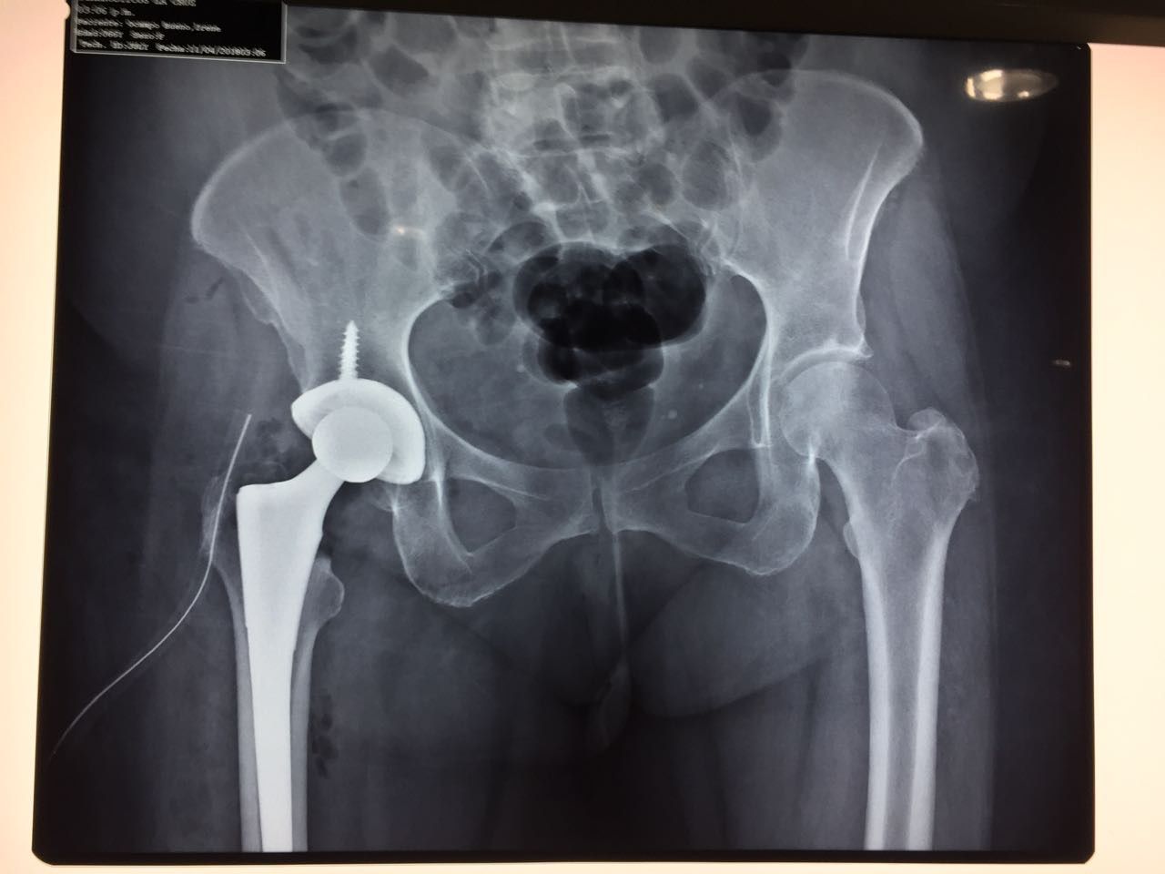 Alberto Viñas Silva-8