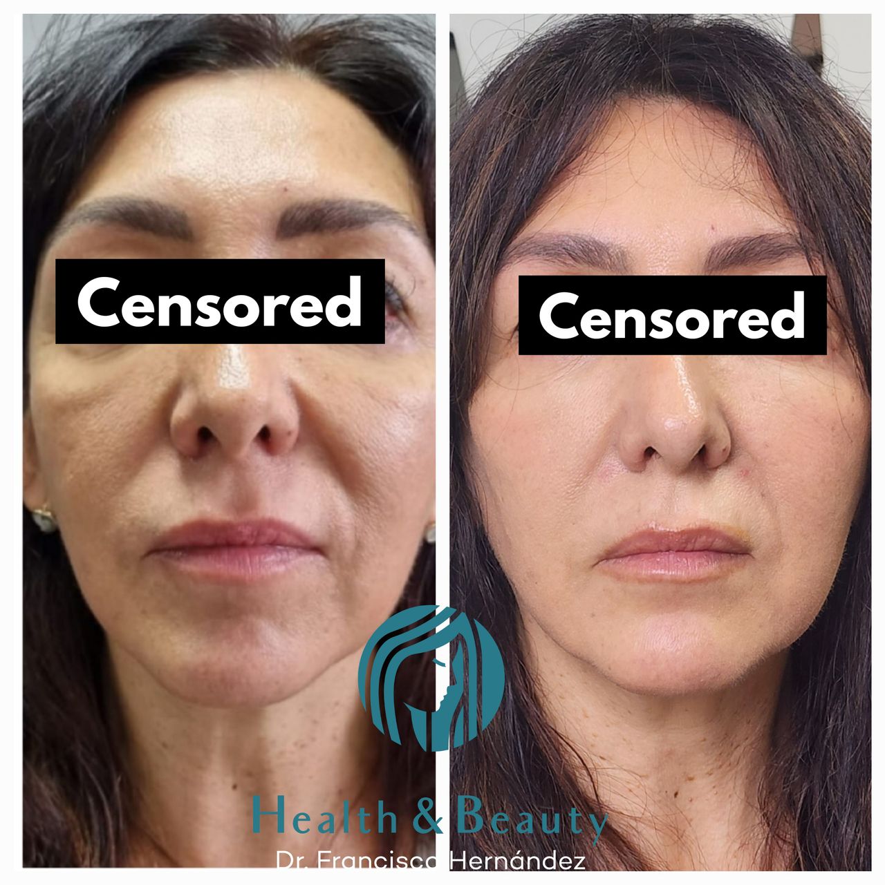 Francisco Hernández Gómez Crespo-5