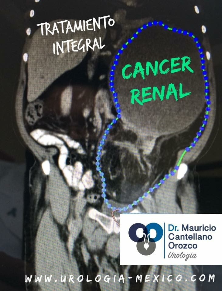 Mauricio Cantellano Orozco-15