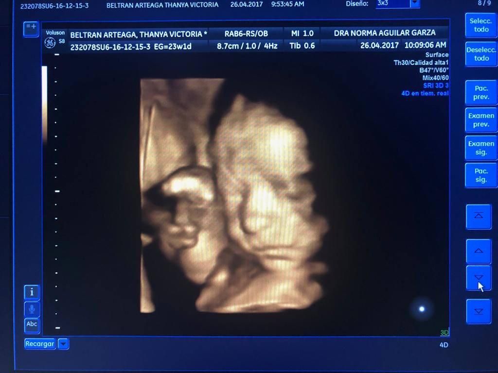 Norma Aguilar Garza-9