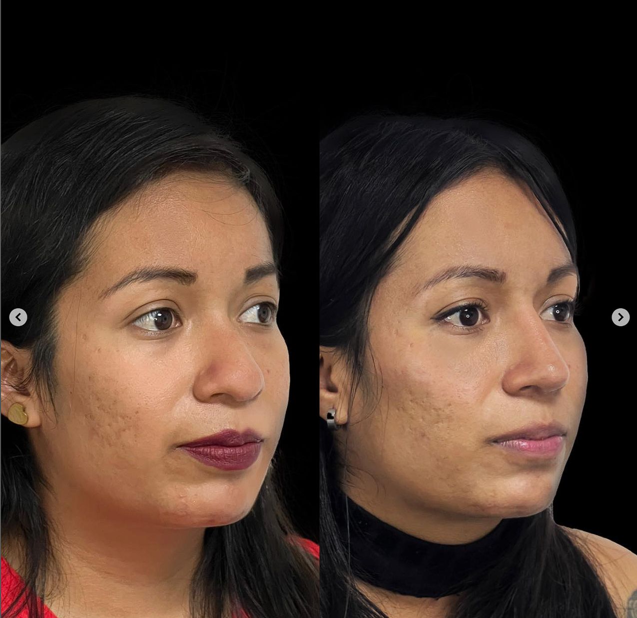 Carlos Alfonso Romero Gameros-21