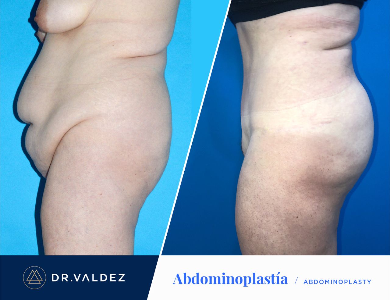 Pedro Arturo Valdez Gomez-27