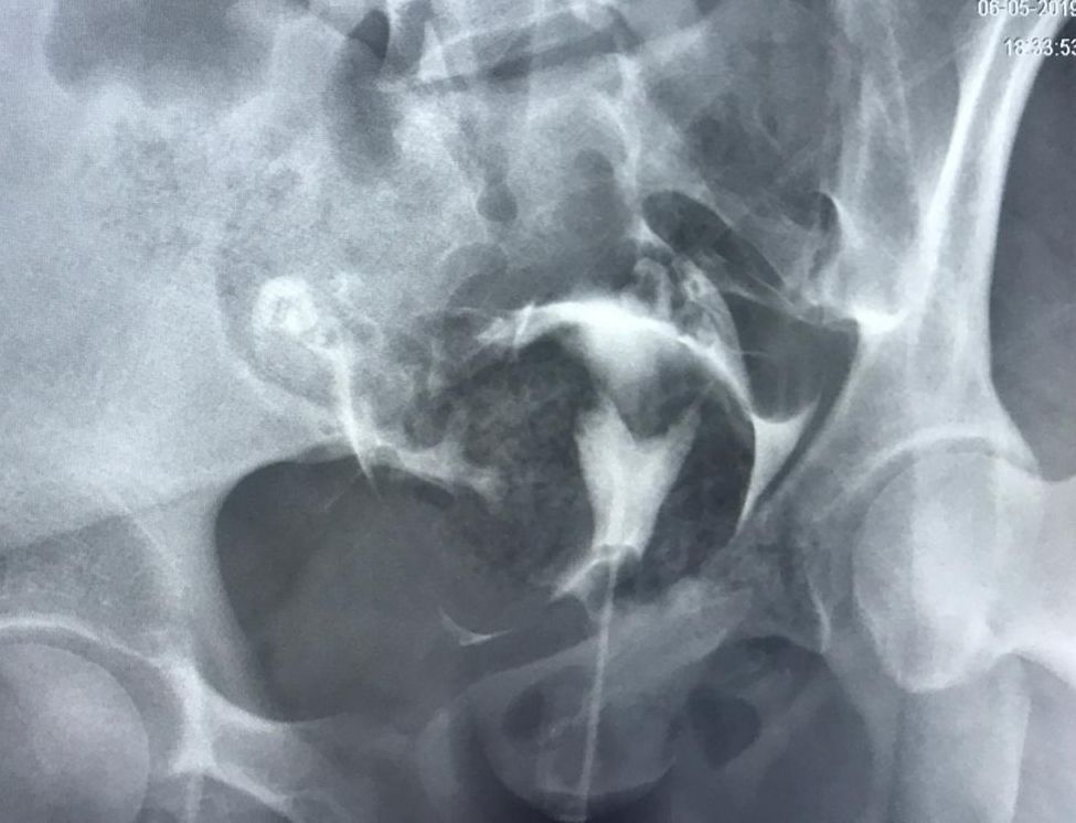 Germán Gabriel Palacios López-33