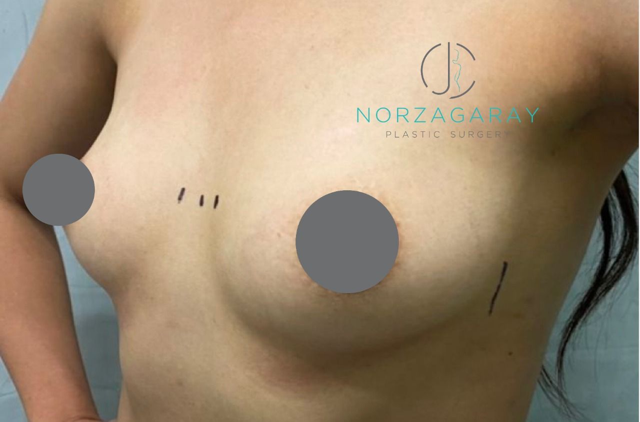 Juan Carlos Norzagaray-17