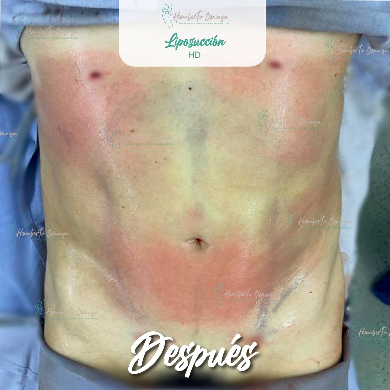 Humberto Osnaya Moreno-18