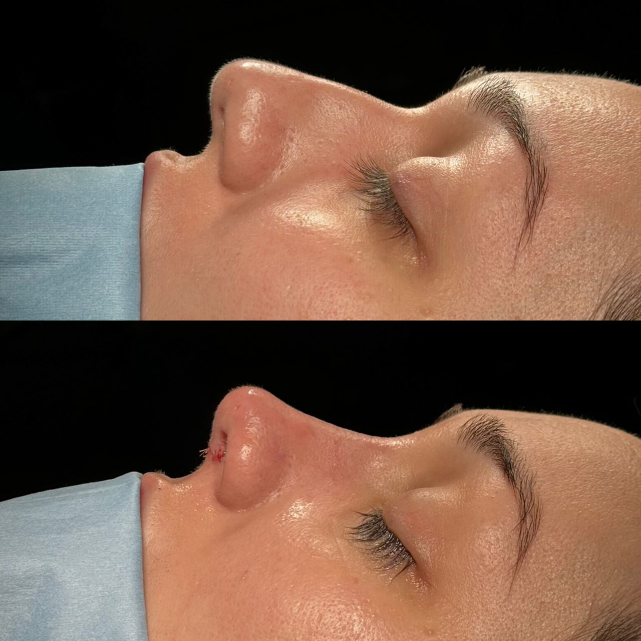 Angel Castro Urquizo-123