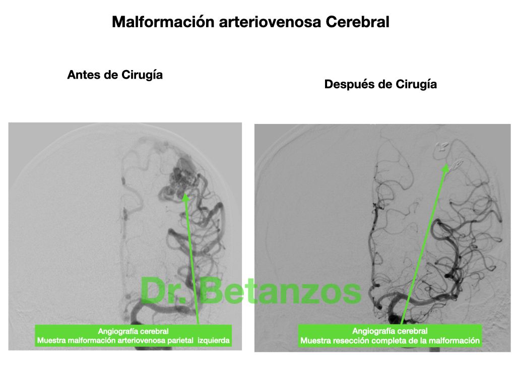 Aleixandre Betanzos Villegas-5