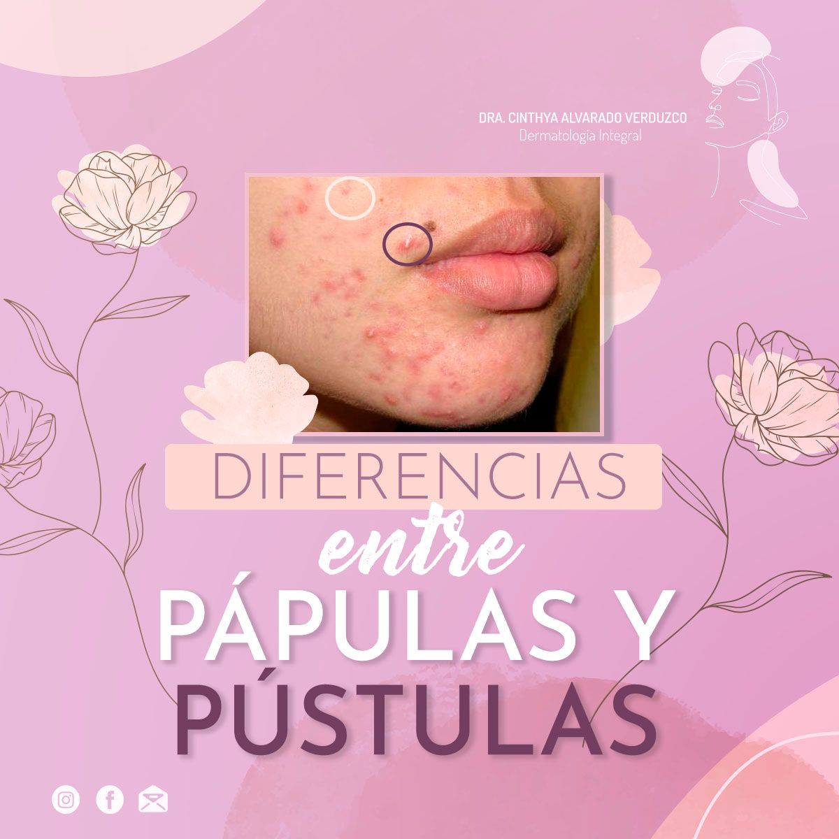 Cinthya Alvarado Verduzco-19