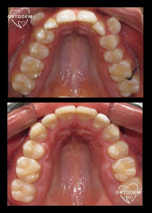 Elizabeth Morelos Morales-24