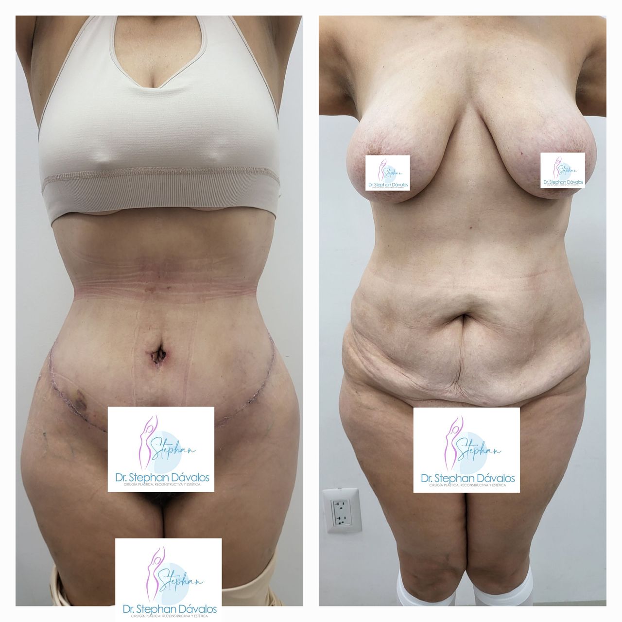 Stephan Dávalos Barrios-13