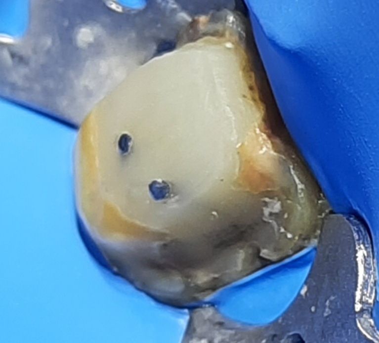 Oscar Justo Bustos-5