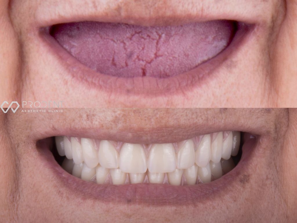 Ulises Pérez Murillo-54