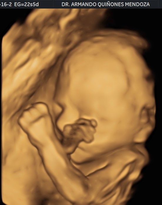 Armando Quiñones Mendoza-8