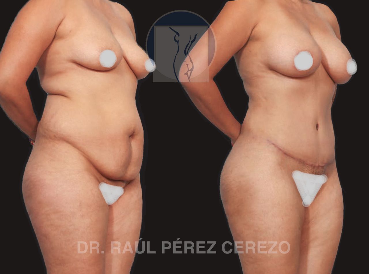 Raúl Pérez Cerezo-6